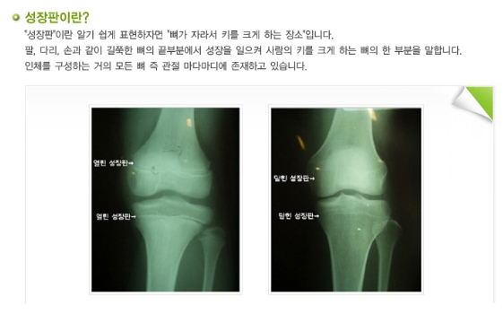 성장판 검사 이미지