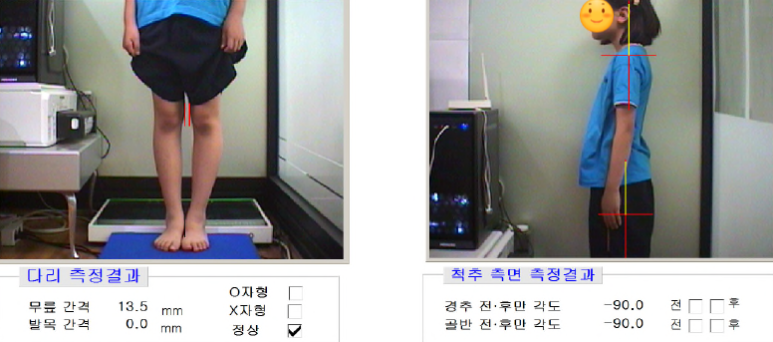 초기 자세 사진