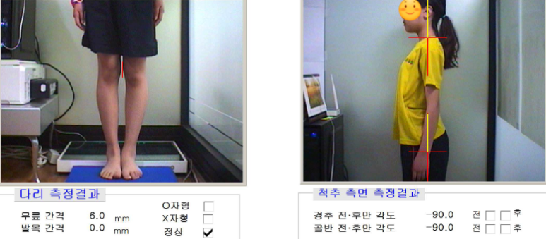 최종 자세 변화