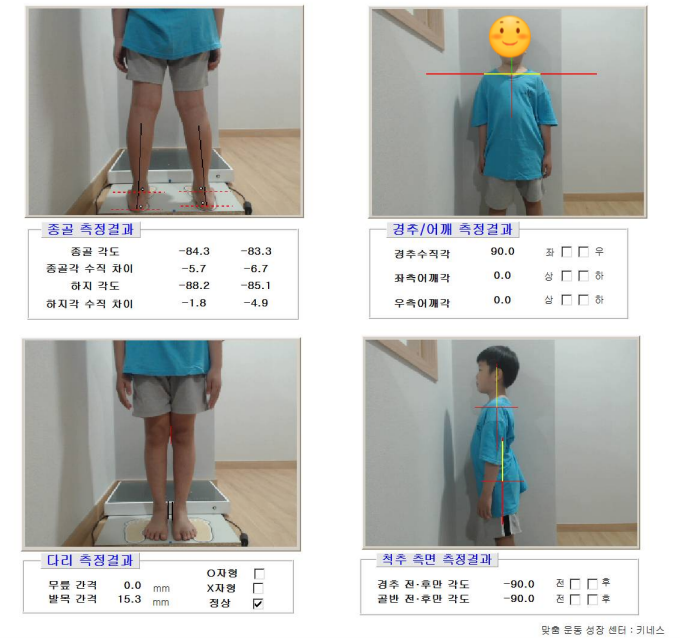 178fedf762bb1e8f23a9adb3c2cf0a83_1781587499_9811.png 178fedf762bb1e8f23a9adb3c2cf0a83_1781587499_9811.png