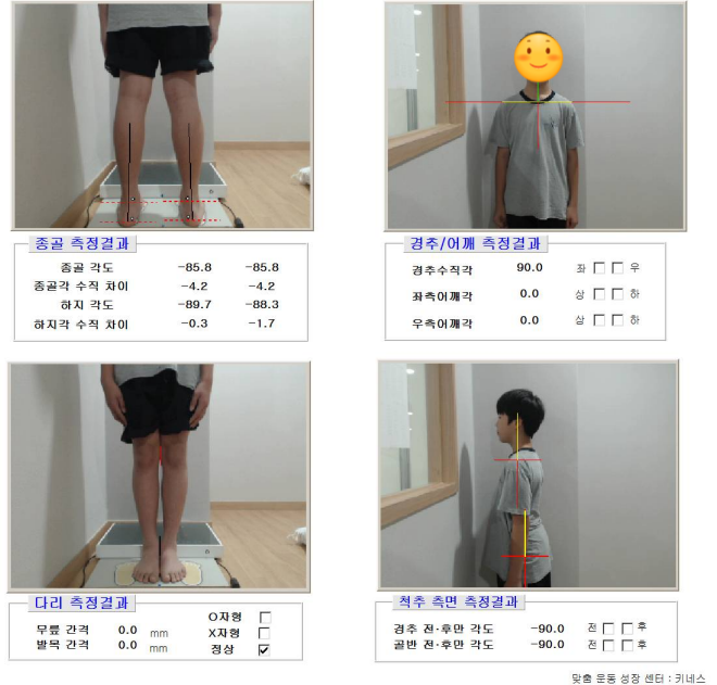 178fedf762bb1e8f23a9adb3c2cf0a83_1781587504_1425.png 178fedf762bb1e8f23a9adb3c2cf0a83_1781587504_1425.png